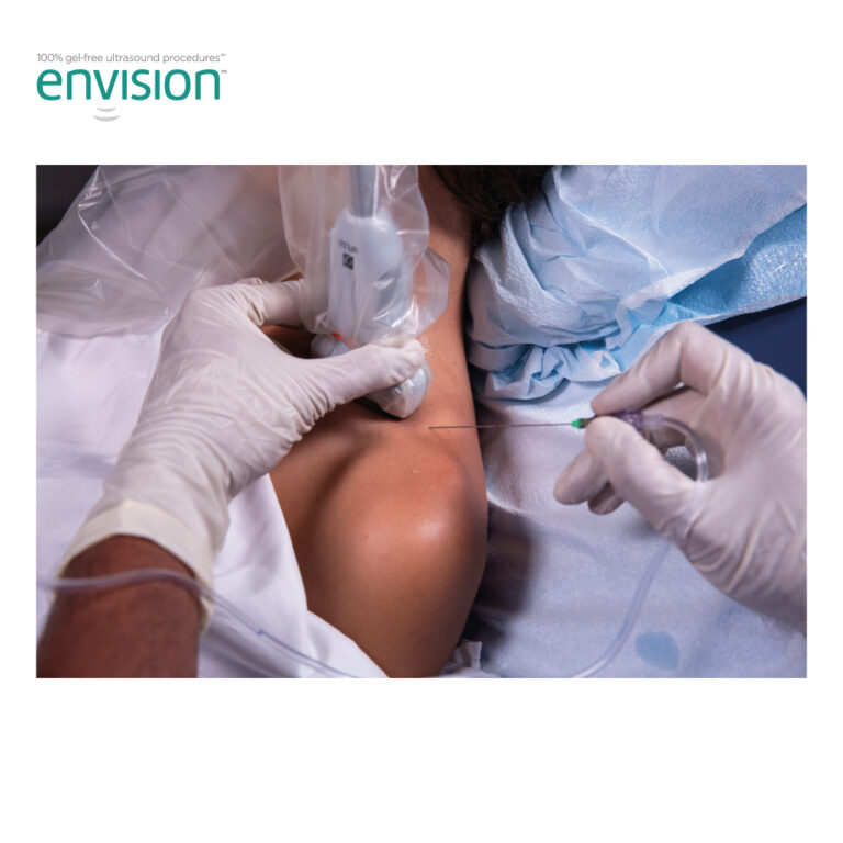 Envision™ Capa de Transdutor de Uso Geral